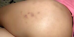 Aftermath of some birthday spankings 🎂